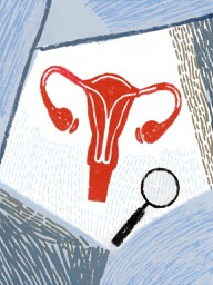 Gynécologue en ligne à Dakar